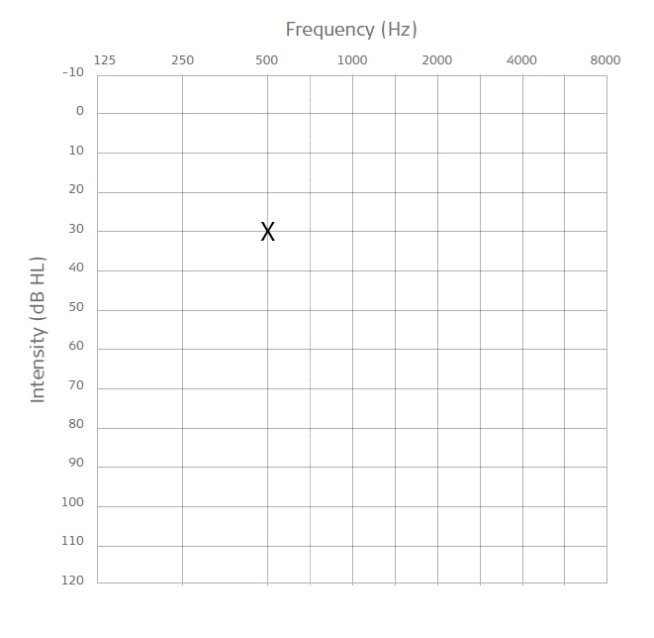 What Is An Audiogram? | The Med El Blog In Blank Audiogram Template Download